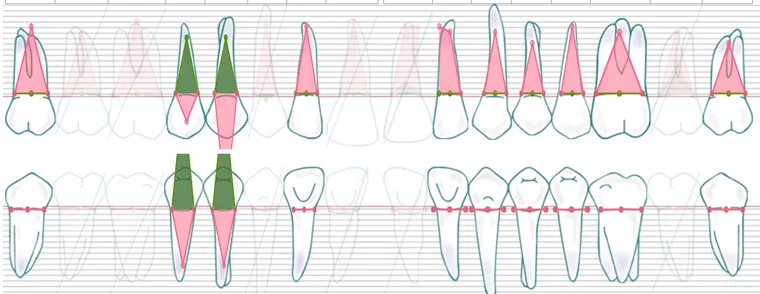 Periodontal chart in dROOT