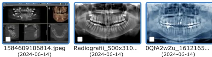 X-rays in dROOT