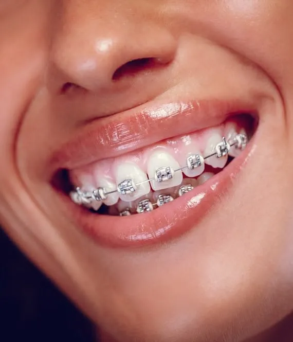 Orthodontic treatment