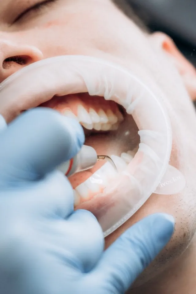 Prosthetic work