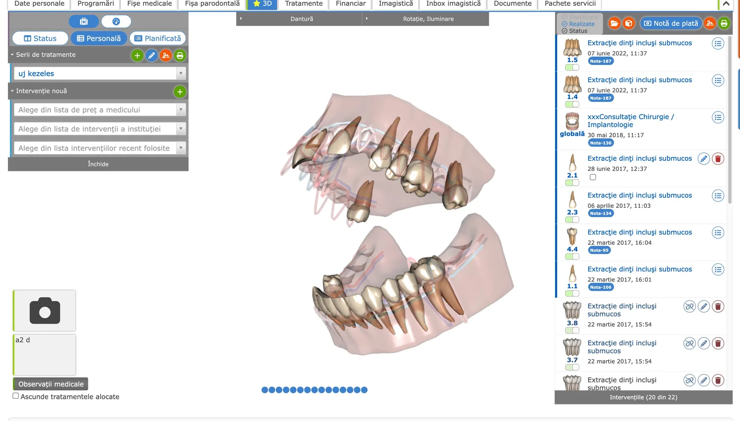 Planul de tratament 3D în aplicația dROOT